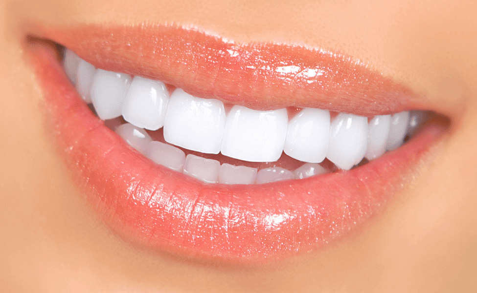 Perfect Smile: Bollywood Smile: Smile Designing: Cosmetic Dentistry – Blogs